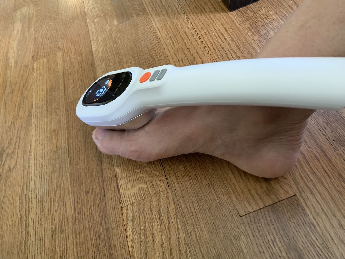 Customer photo review of DERNOX™ Handheld Pain Relief Cold Laser Device
