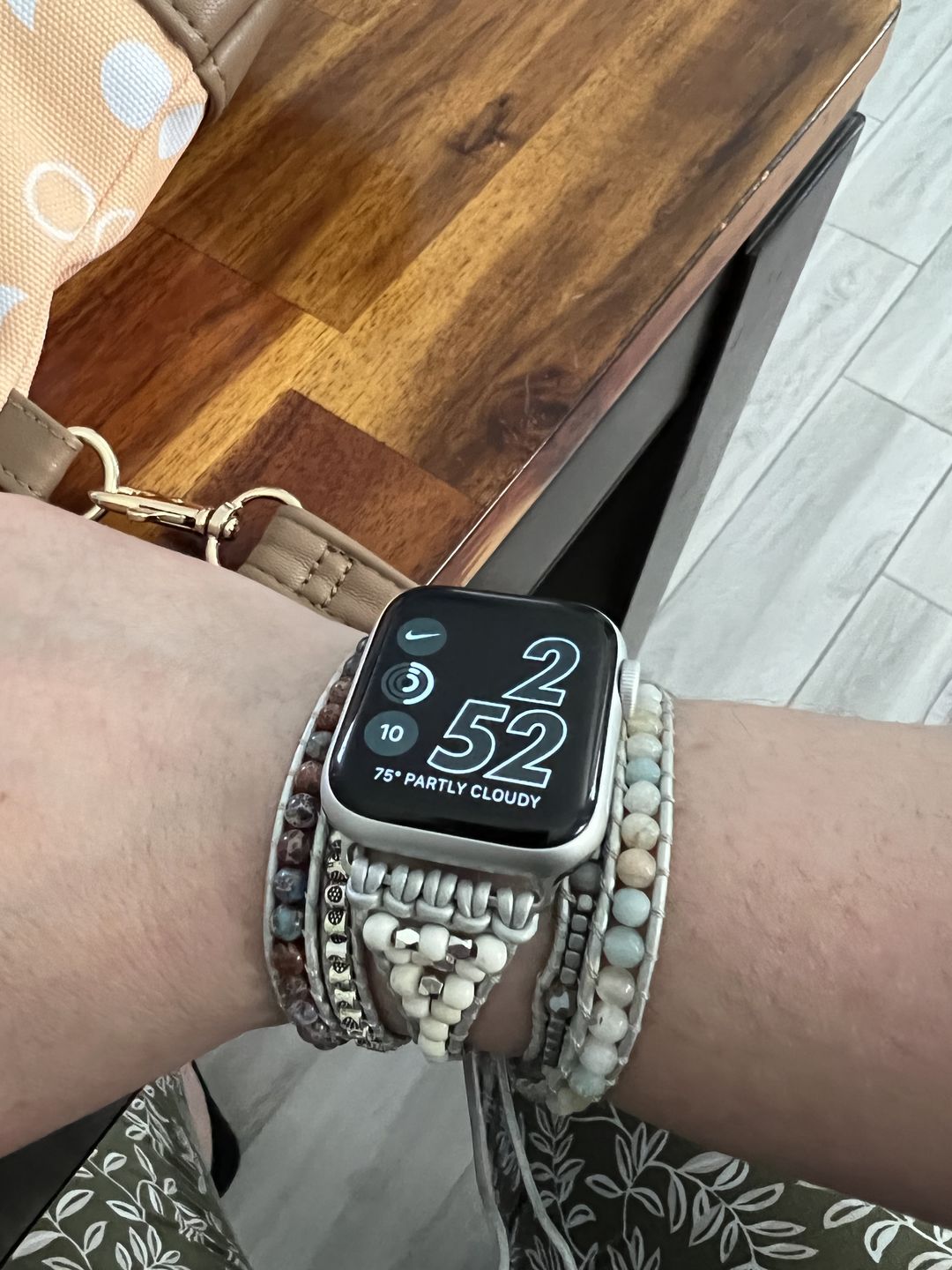 Customer photo review of Healing Turquoise Protection Apple Watch Strap