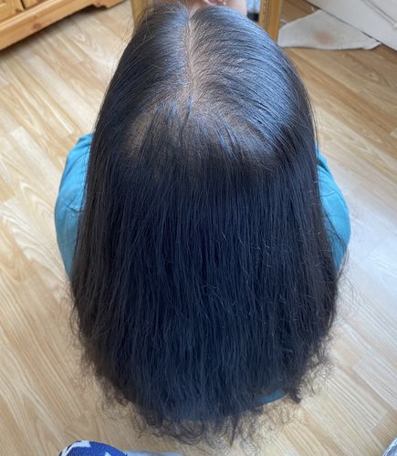 Customer photo review of Growth & Shine Hair Oil