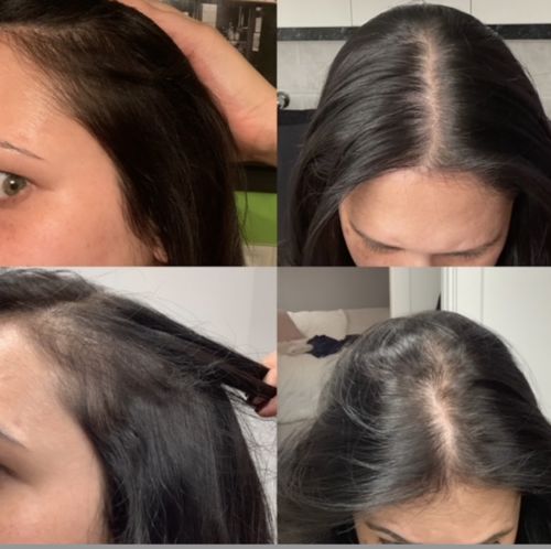 Customer photo review of Growth & Shine Hair Oil