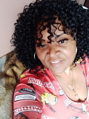 Customer photo review of WrinkleFix: Botox (Existing Customers)