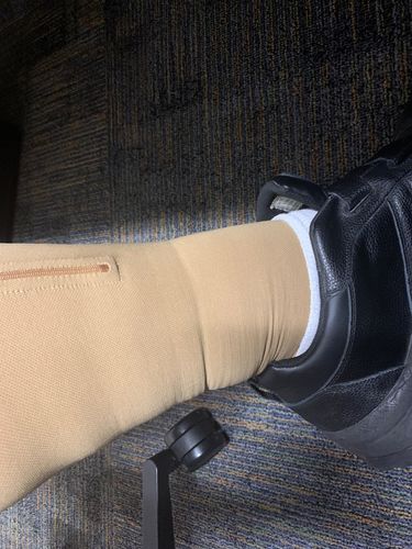 Customer photo review of BenVård™ Åderbråck Förebyggande Strumpor