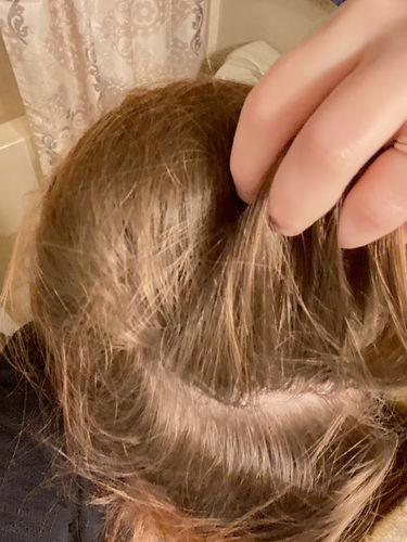 Customer photo review of Pulp Riot Berlin Dry Shampoo