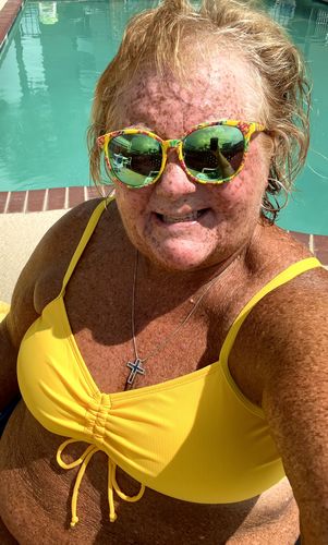 Customer photo review of 100% Natural & Organic Tanning Oil