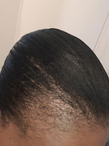 Customer photo review of Kerry Berry Growth Oil