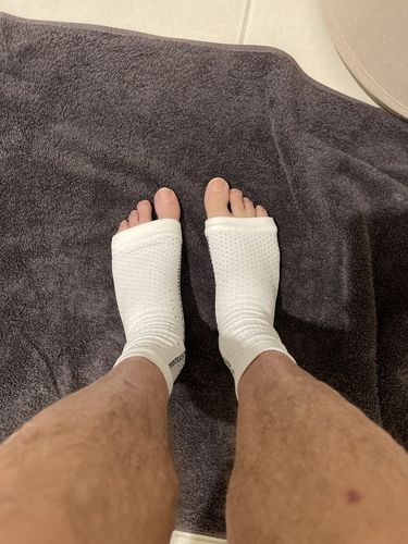 Customer photo review of Buy 2 NeuroSocks