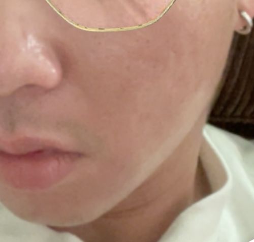 Customer photo review of Niacid