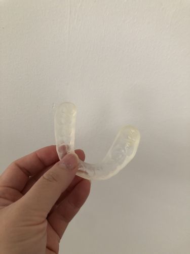 Customer photo review of Night Guard – One-time