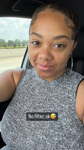 Customer photo review of Acne And Blemish Solution - Large