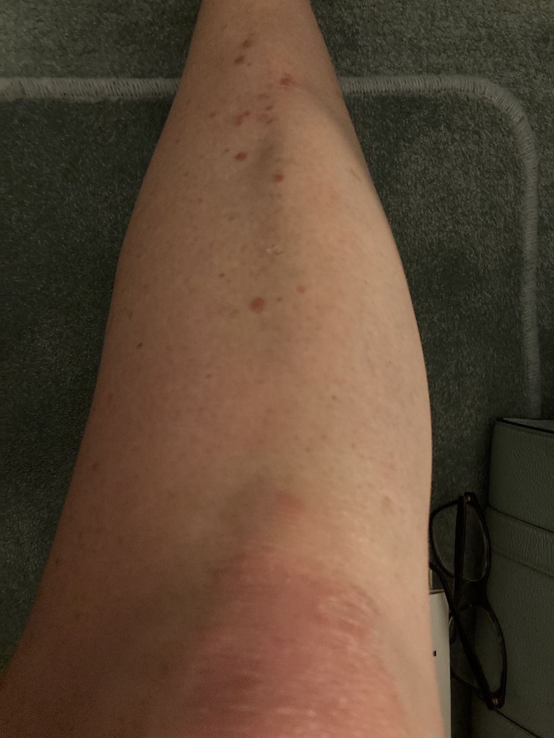 Customer photo review of Intensive Night Balm