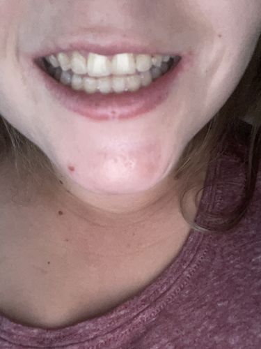 Customer photo review of Gratis Color Corrector