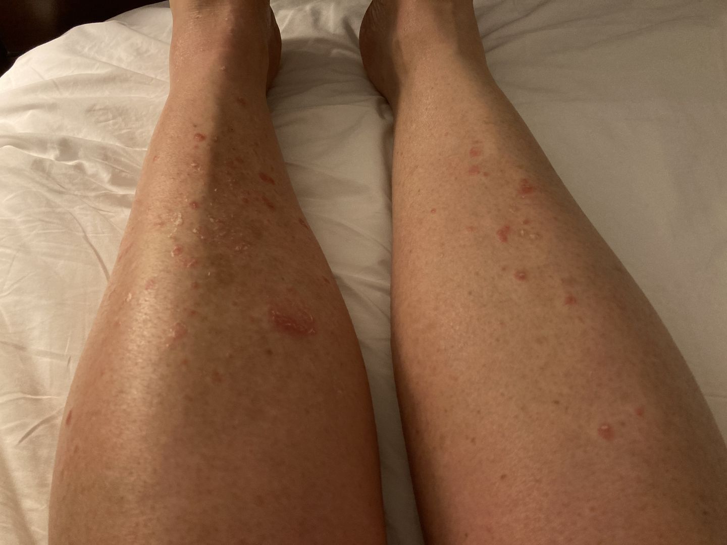 Customer photo review of Soothing Spray