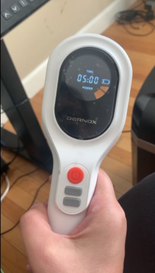 Customer photo review of DERNOX™ Handheld Pain Relief Cold Laser Device