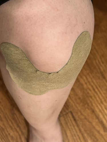 Customer photo review of HexoPatch™ - Natural Knee Pain Relief Kit