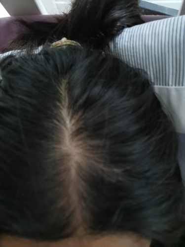 Customer photo review of Growth & Shine Hair Oil