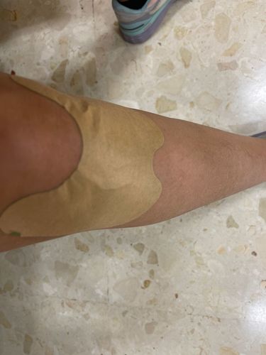 Customer photo review of HexoPatch™ - Natural Knee Pain Relief Kit