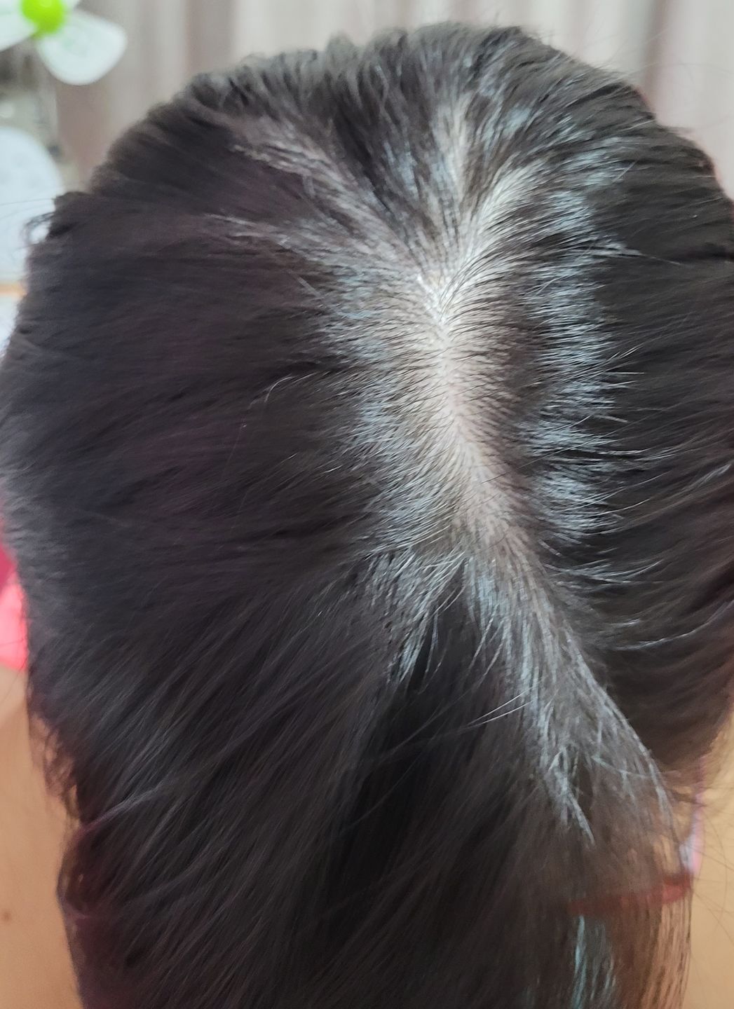 Customer photo review of [ SMIB ] - 500ML Coral Calcium Shampoo