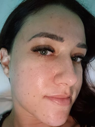 Customer photo review of Niacid