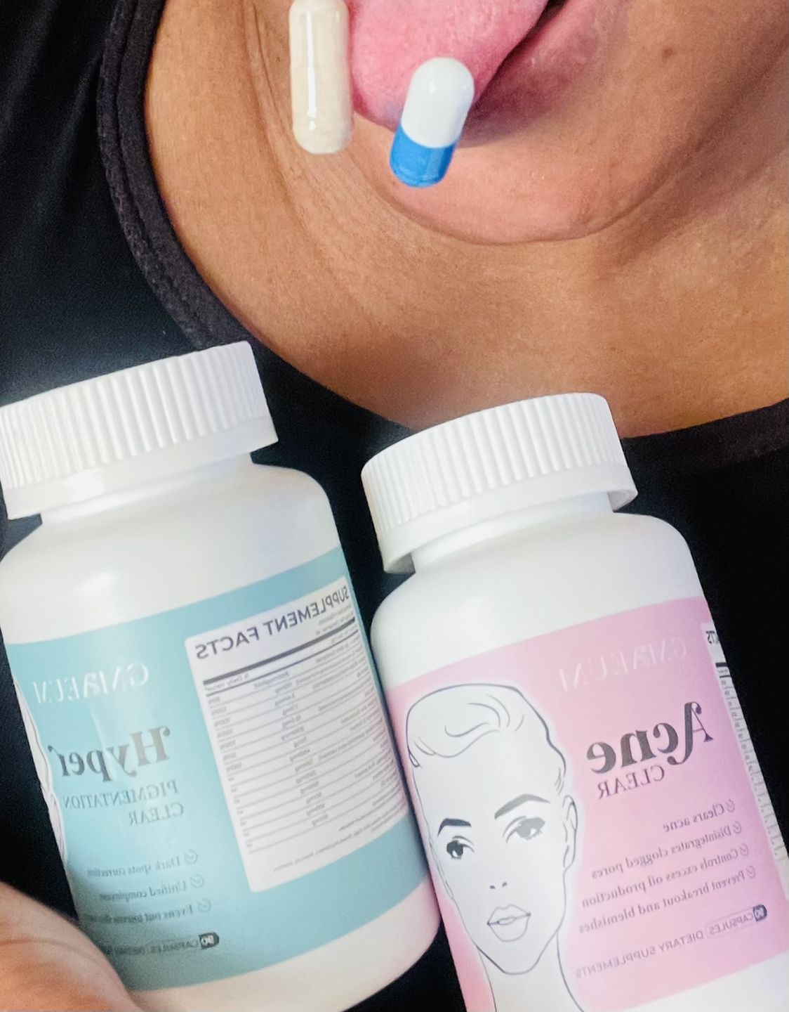 Customer photo review of Gmaeum Clear Complexion Set