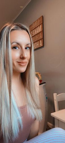 Customer photo review of HairRebirth Herbal Spray（Limited time discount 🔥 last day）