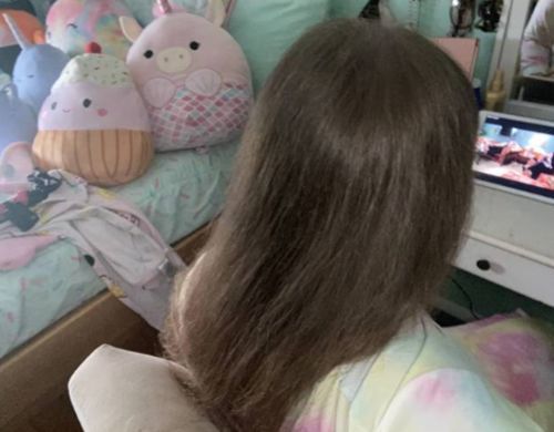Customer photo review of HairRebirth Herbal Spray（Limited time discount 🔥 last day）