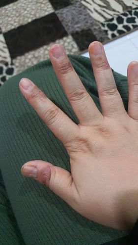 Customer photo review of Jolicare™ Cream (Collagen)