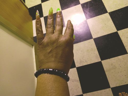 Customer photo review of Weight Loss Black Stone Magnetic Therapy Bracelet