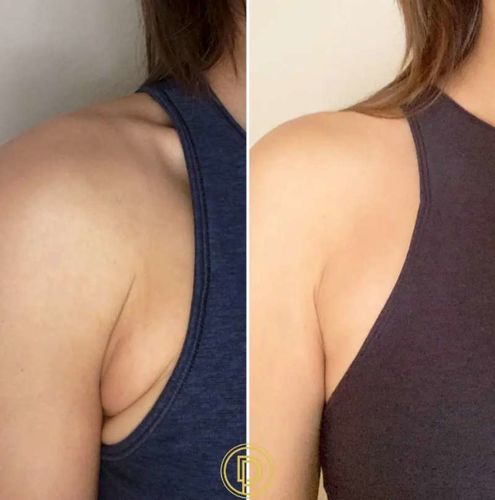 Customer photo review of SmalSnabbt™ Ingefära Detox Olja