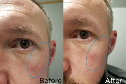 Customer photo review of 【🔥Hot sale 45% OFF 】Seaweed Tightening Eye Mask