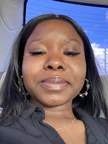 Customer photo review of Tea Tree Daily Face Wash/Cleanser