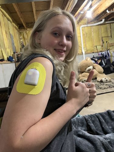 Customer photo review of Skin Grip Omnipod Adhesive Patches
