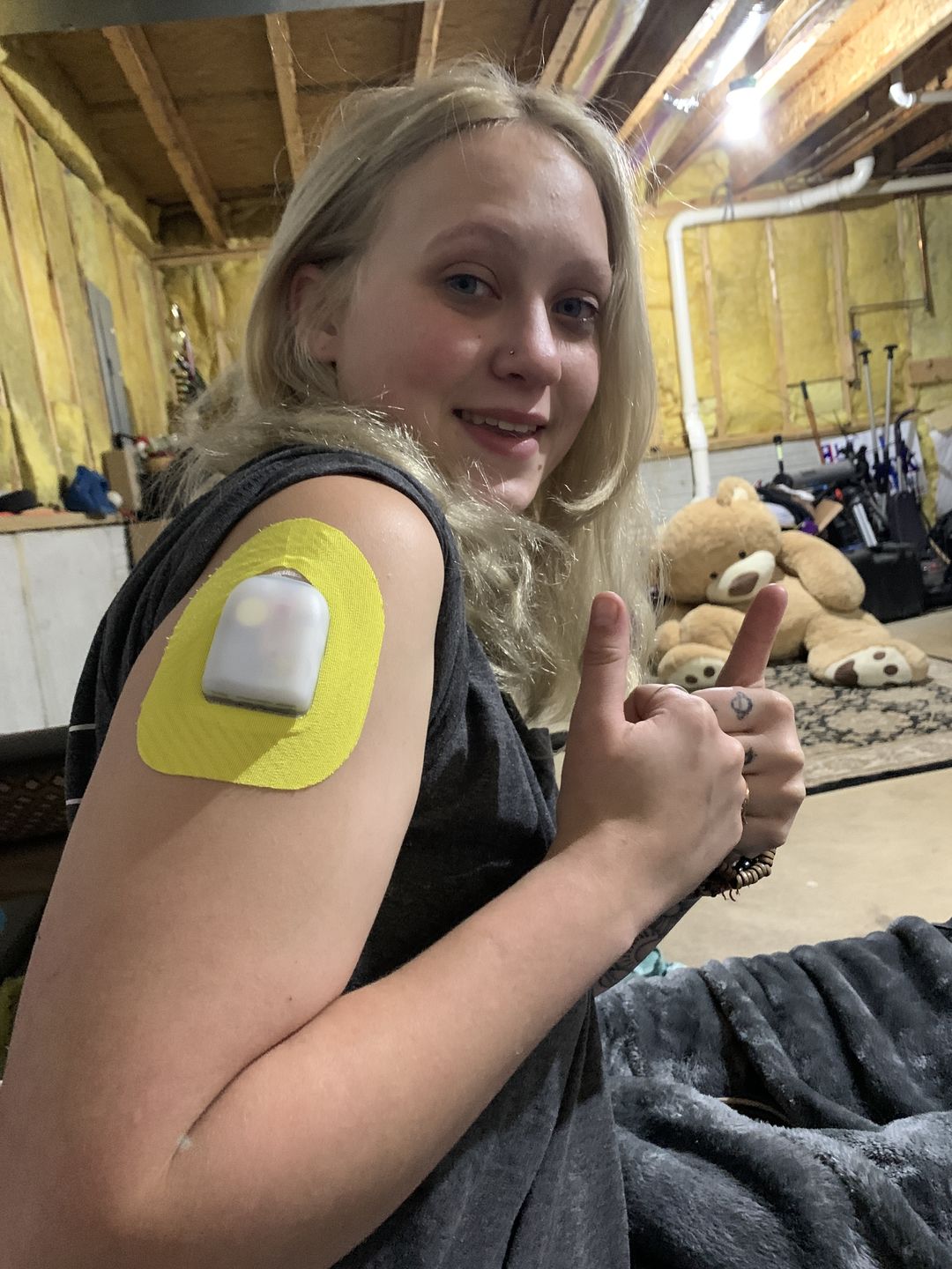 Customer photo review of Skin Grip Omnipod Adhesive Patches