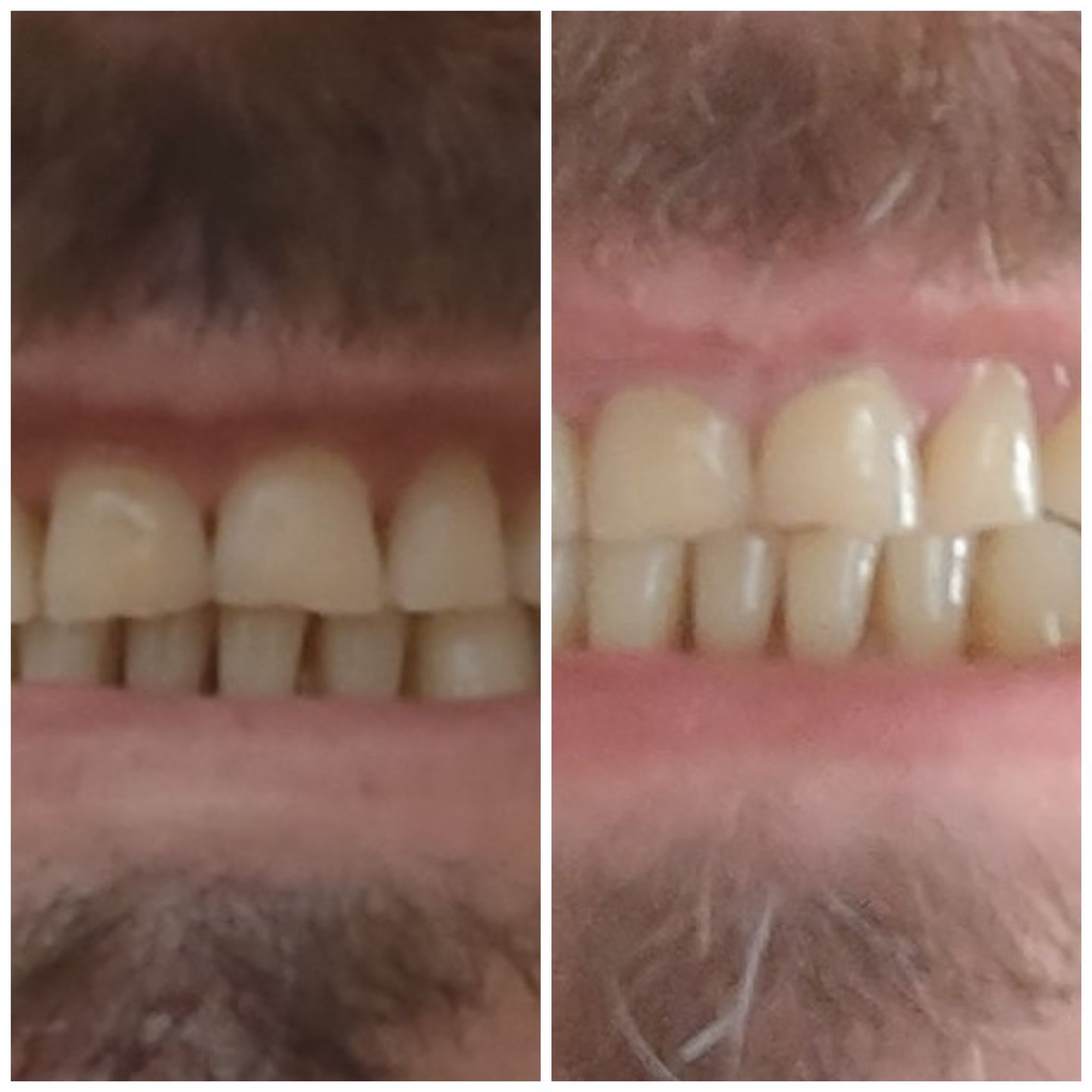 Customer photo review of Whiten Together Bundle