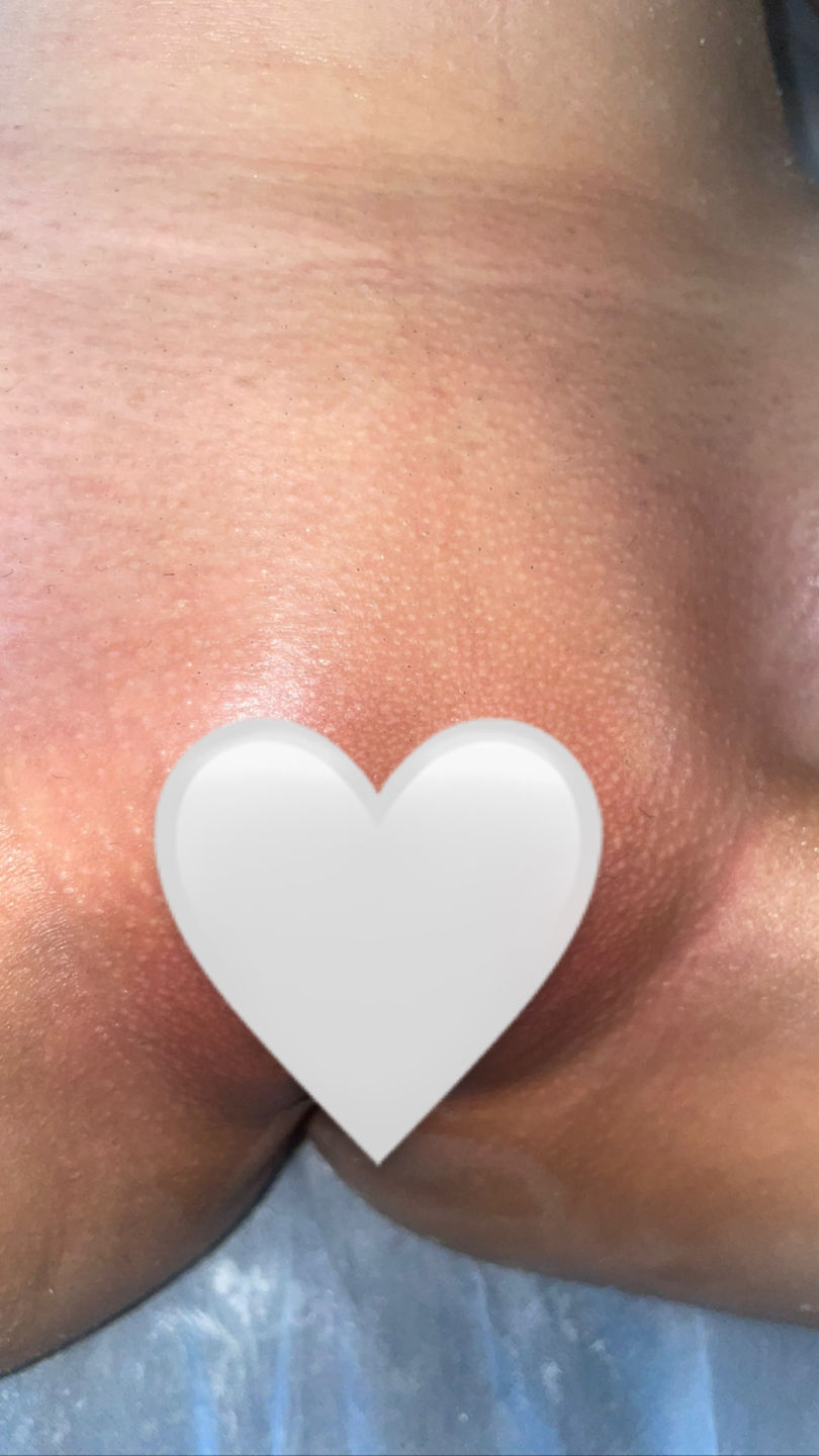 Customer photo review of Hard Wax Combos