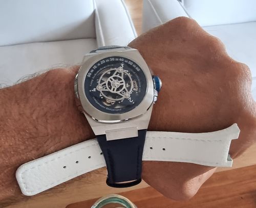 Customer photo review of M3/M3W Lorica® straps