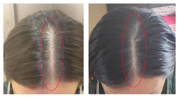 Customer photo review of [ SMIB ] - Premium Starter Kits 500ml Set