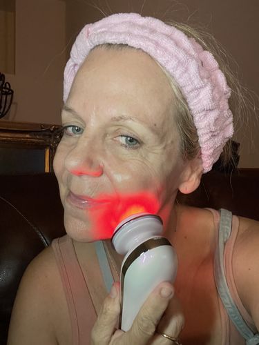 Customer photo review of EvenSkyn® Lumo: Premium Anti-Aging & Skin Tightening Handset