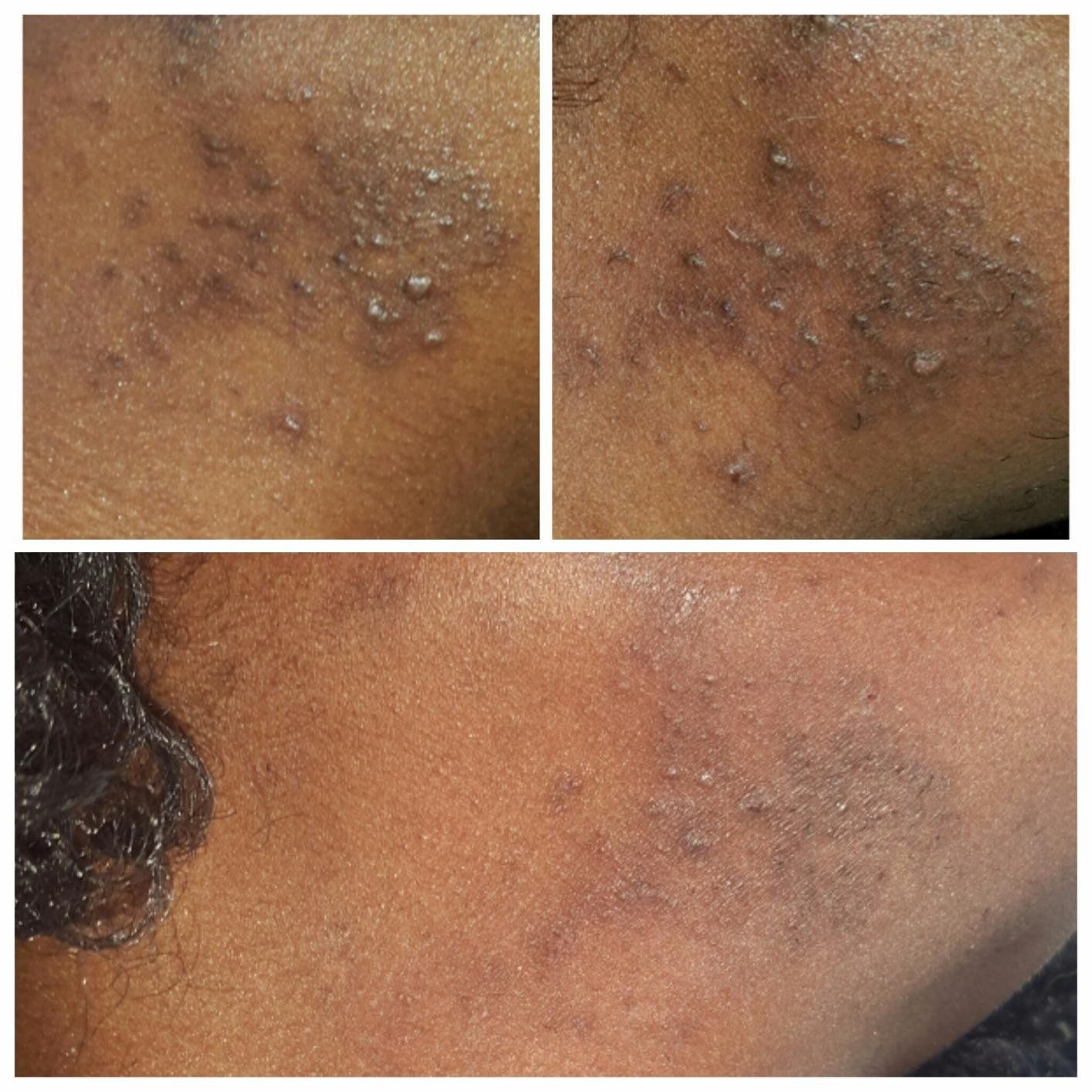 Customer photo review of Fair and White Original Exfoliating Soap 200 gm / 7 oz