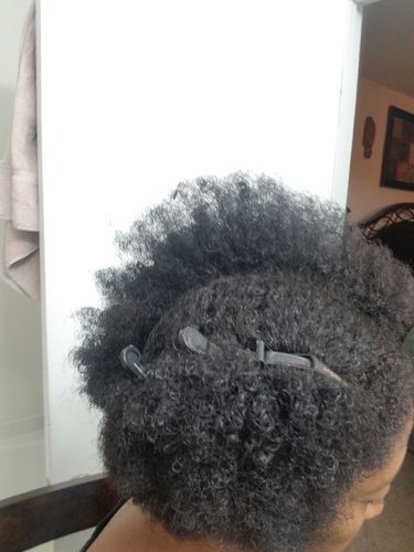 Customer photo review of Hair Recovery Bundle