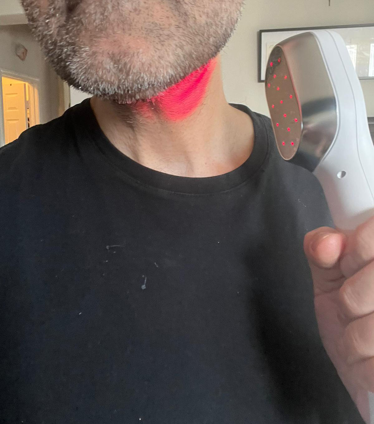 Customer photo review of DERNOX™ Handheld Pain Relief Cold Laser Device