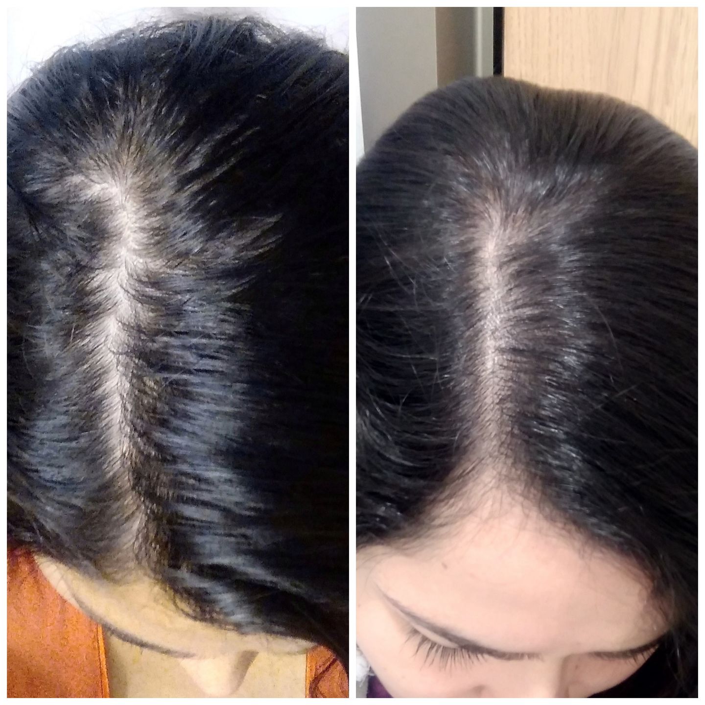 Customer photo review of Anticaída para 3 meses
