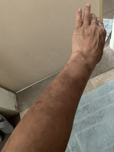 Customer photo review of Jolicare™ Cream (Original)