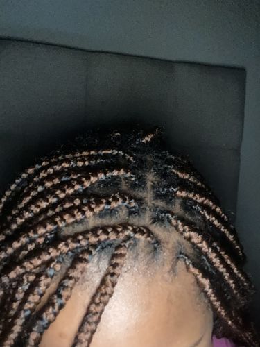 Customer photo review of Rice Water Hair Growth Kit
