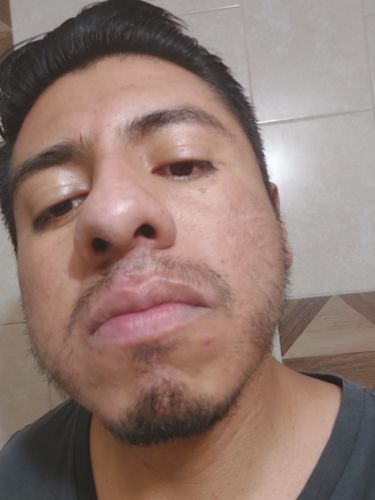 Customer photo review of Kit de Crecimiento de Barba y Bigote Bálsamo Minoxidil 15% + 1 Aceite Premium