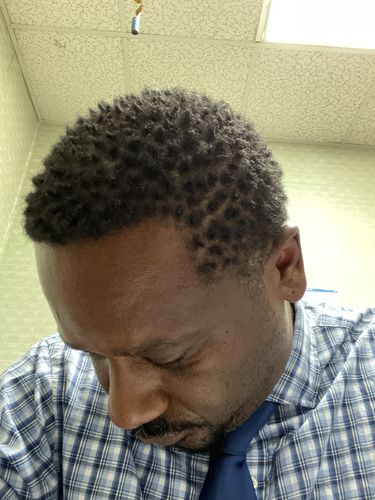 Customer photo review of Herbal Hair/Beard Growth Oil