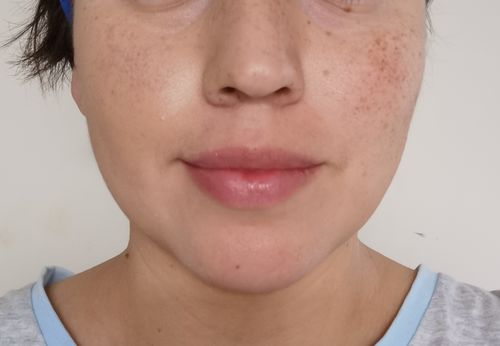 Customer photo review of SAMPLES of Natural Face Sunscreens - our multitasking heroes