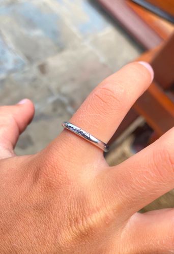 Customer photo review of The Smile More Ring™ - Operation Gift a Smile (Solo Bundle)
