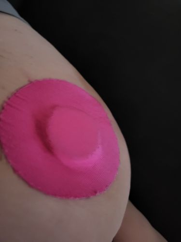 Customer photo review of Skin Grip Freestyle Libre Adhesive Patches