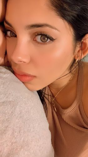 Customer photo review of Neala Brown Contact Lenses(12 months wear)