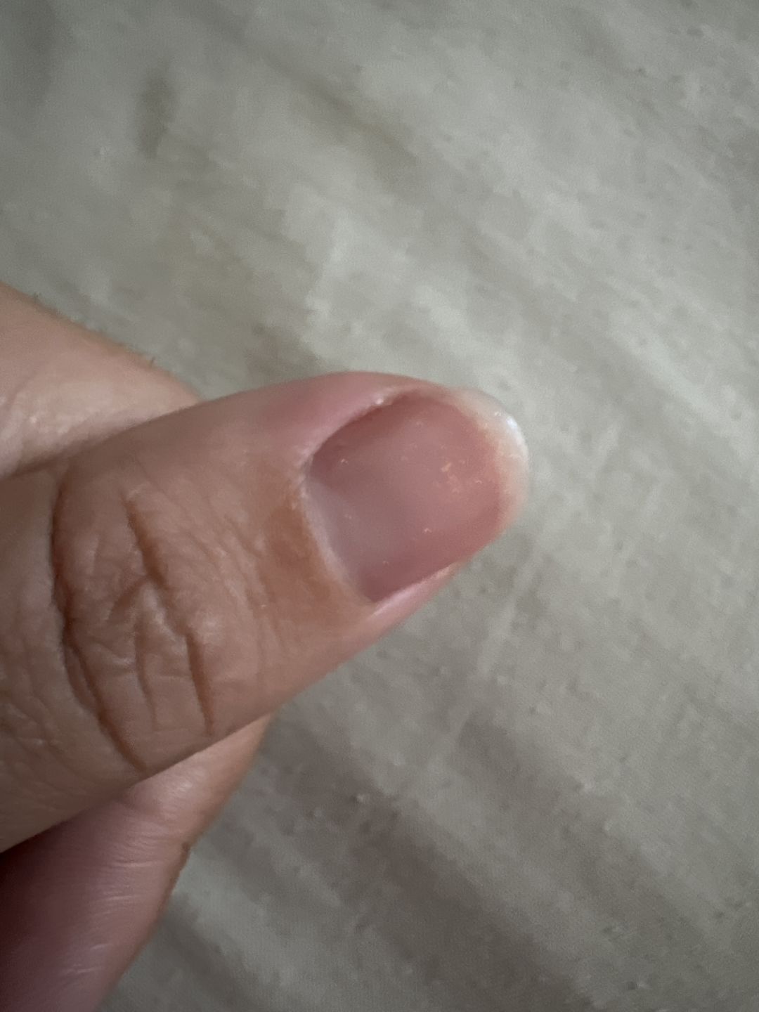 Customer photo review of Semilac Vitamin Primer for Nail Gel Polish 7 ml